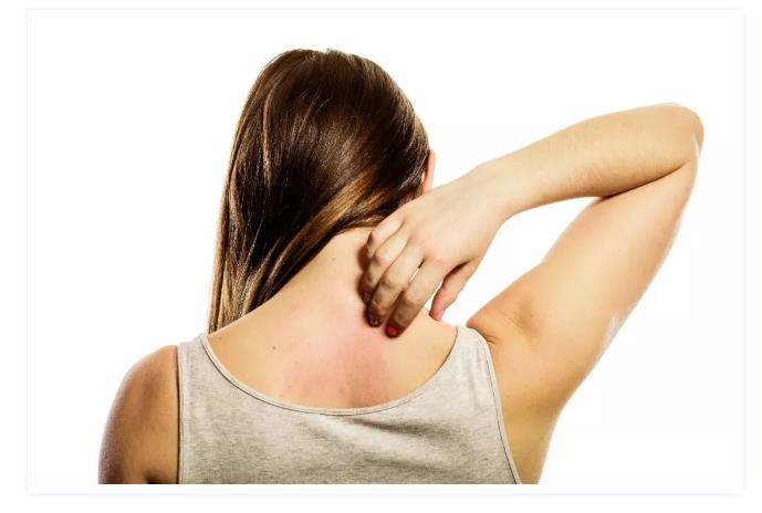 皮膚的抑菌、清潔、止癢