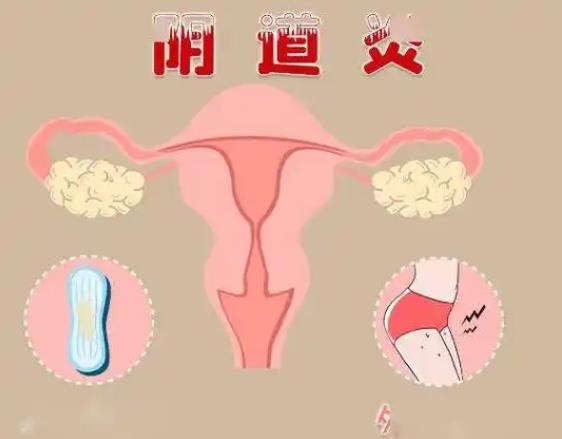 婦科凝膠貼牌廠家